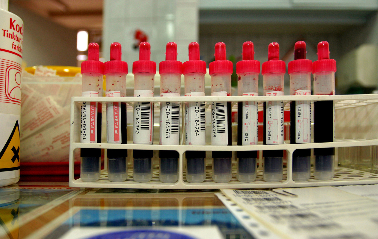 BLOOD TESTS BLOOD TESTS